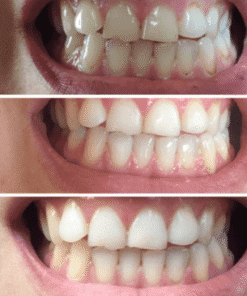 Teeth Plaque Remover Whitening Essence