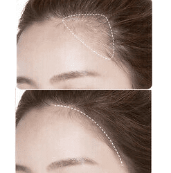 Hairline Powder For Thinning Bald Hair