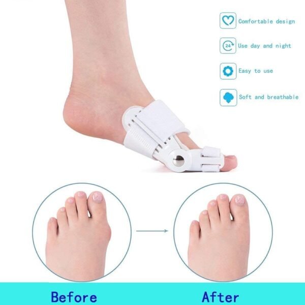 bunion corrector for big toe straightening toe separator brace