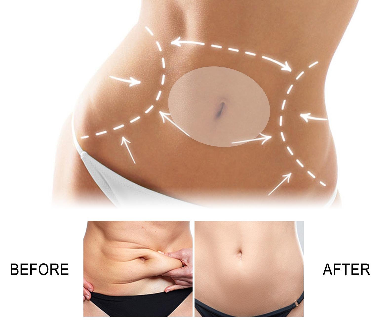 Tummy Belly Lifting Adhesive Tape