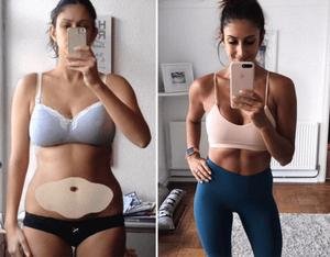 Fat burning belly patch for slimming weight loss support and body contouring