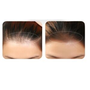 Hairline powder for thinning bald hair for fuller looking hair and natural coverage