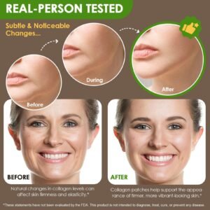 collagen patch supporting firmness elasticity and reducing fine lines appearance